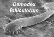 Demodex folliculorum SEM crop